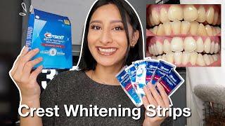 I TRIED THE CREST 3D WHITESTRIPS FOR 14 DAYS *Effective* | Before & After pictures