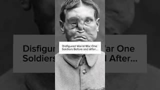 Disfigured World War One Soldiers Before and After #ww1 #warshorts #warhistory #military