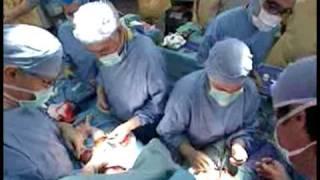 Conjoined twins separated in Paris hospital