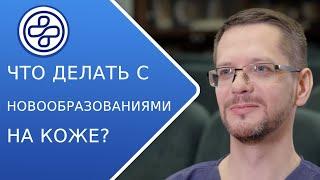 Что делать с новообразованиями кожи? Дерматоонкология. Дерматологи МНПЦДК.