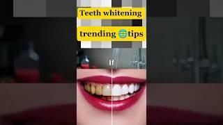 Teeth whitening tips for better smile #trending #guidance #smile #teeth #whitening #yt #short #viral
