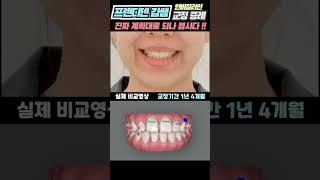 1년4개월을 30초만에 확인하기. 인비절라인 비교영상, 비발치교정 (치아교정 기간 1년 4개월 후기)