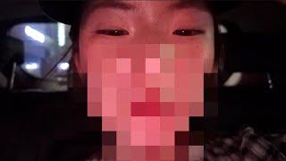 한국 온김에 성형외과 간 유학생 브이로그