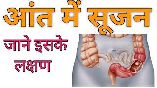 colitis | aant me sujan ke lakshan | आंत में सूजन के लक्षण | aant me sujan ki homeopathic medicine