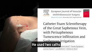 Catheter Delivered FoamSclerotherapy for Incompetent GSV