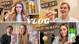 DANČA SI BARVÍ VLASY, KUBA MÁ NOVÉ ZUBY, OTEVÍRÁME MYSTERY BOXY! VLOGMAS 6