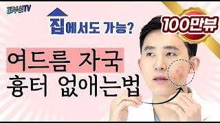 피부과 전문의가 알려주는 여드름자국 흉터 없애는 법  [피부과전문의 피부심]