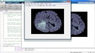 Image Processing Projects Using Opencv | Image Processing Thesis Using Opencv