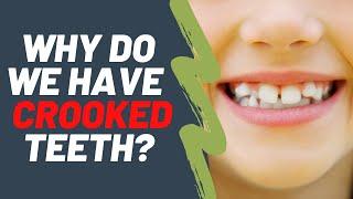 Why do we have crooked teeth | Dentist Explained (2021)