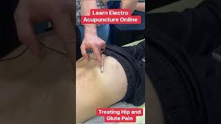 Learn electroacupuncture online now #electroacupuncture #acupuncture ￼