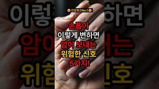 손톱이 이렇게 변하면 암이 보내는 위험한 신호 5가지! ##건강 #건강정보 #건강관리