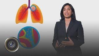 SnapShot Interactive | Cystic Fibrosis Foundation "Anti-Inflammatory"