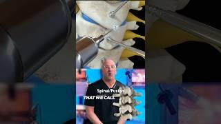 Can Spinal Fusion Lead to MORE Spine Surgery? #shorts