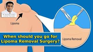 When you should go for Lipoma Removal Surgery? | Lipoma Removal in hyderabad