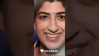 Nasal splint removal after rhinoplasty surgery in Iran 2023- Avamedi 03