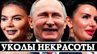 «УКОЛЫ НЕКРАСОТЫ» - НАШИ ЗВЕЗДЫ, КОТОРЫЕ ПЕРЕБОРЩИЛИ С БОТОКСОМ И ФИЛЛЕРАМИ