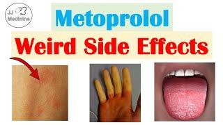 Metoprolol (& Beta Blockers) Weird Side Effects (Skin, Gastrointestinal, Psychological)