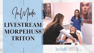 InMode Livestream: Morpheus8 & Triton Laser Hair Removal