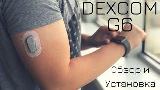 Полный обзор Dexcom G6. Распаковка, установка Декском Г6. Первые впечатления!