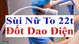 Thực Hiện Khám Chẩn Đoán Sùi Mào Gà Nữ 22t & Tiến Hành Xử Lý Loại Bỏ Sùi Bằng Đốt Dao Điện | Bs Sắc