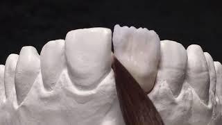 KATANA dentina fresata: stratificazione con CZR - anteriore