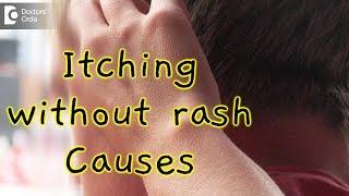 What causes itching all over without a rash? - Dr. Rasya Dixit