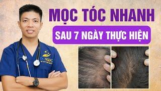 Bật mí 4 động tác massage đơn giản giúp tóc dày và khỏe mạnh chỉ sau 7 ngày | Dr Ngọc