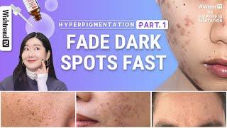 How to Get Rid of Hyperpigmentation, Brightening Skincare Routine | Fade Face Dark Spots Fast part.1