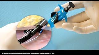 US Perclose ProStyle Single Device Deployment Animation