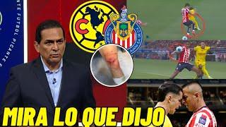 FMF CONFIRMA CASTIGO CLUB AMERICA FUE VÍCTIMA DEL ARBITRAJE, EL VAR DESAPARECIÓ CLUB AMÉRICA HOY