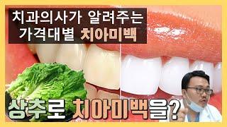 치과의사가 알려주는 가격대별 치아미백 방법.