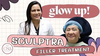 Collagen & Hyaluronic Filler Treatment Using Sculptra and Restylane Refyne | Dr. Contessa Salvador