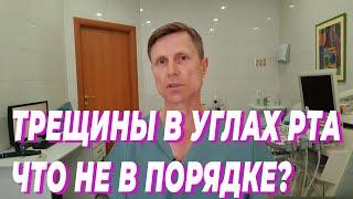 Трещины в углах рта. Что не в порядке?