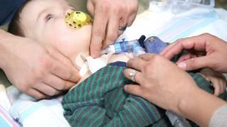 How to Do a Routine Trach Change | Cincinnati Children's