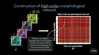 Unsupervised Autism Diagnosis using High-order Morphological Brain Networks (Best Paper Award 2018)