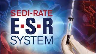 Sedi-Rate ESR System from Globe Scientific