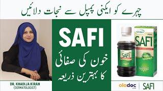 Pimples Ka Ilaj - Glowing & Clear Skin - Hamdard Safi Benefits & Uses - Acne Khatam Karna Ka Tarika