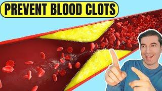 Top 7 Natural Remedies Against BLOOD CLOTS