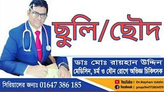 ছুলি || ছৌদ || Pityriasis versicolor || Dr.Rayhan Uddin