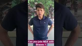 Don’t join NDA with Braces ? #ssb #ssbmedical #ssbInterview #ssbpreparation #nda #defenceacademy