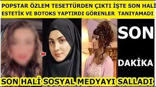 Popstar Özlem tesettürden çıktı, estetik yaptırdı, sahnelere döndü! Son hali sosyal medyayı salladı