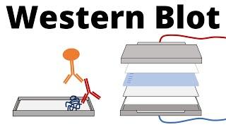 Western Blot / Protein Immunoblot explained