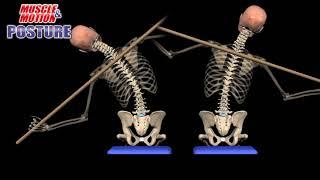 Lateral Flexion - Postural Assessment