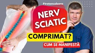 Este comprimat nervul sciatic? Ce manifestări are și cum testăm în clinica @DrOrestBolbocean