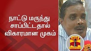 நாட்டு மருந்து சாப்பிட்டதால் விகாரமான முகம் | Vellore | Siddha Medicine