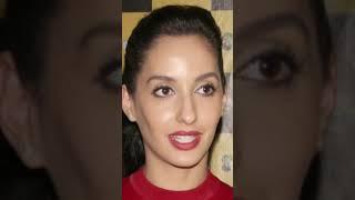 Nora Fatehi Plastic Surgery #nora #beforeandafter #plasticsurgery #norafatehi