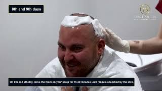 Hair Washing After Hair Transplantation 2023 - Now Hair Time