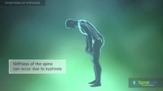 Kyphosis Symptoms