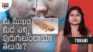 Facts About Face Mites By Torani | TomTom Facts