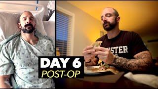 FULL DAY OF EATING AFTER COLON CANCER SURGERY | (6 Days Post-Op)